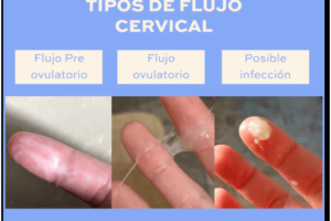 Flujo vaginal: causas, tipos y cómo tratarlo de forma natural