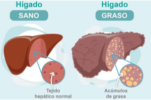 Los Beneficios del Alpiste para el Hígado Graso y la Salud