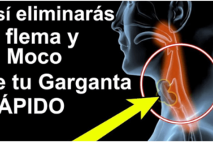 4 Remedios Caseros Eficaces para Eliminar el Moco y la Flema en la Garganta, Sinusitis y Rinitis