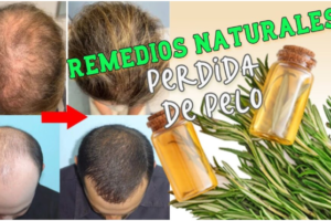 Remedios Caseros para la Caída del Cabello y Uñas Fuertes: Soluciones Naturales Efectivas