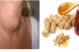 Mejora la Salud de tu Tiroides de Forma Natural con Miel y Nueces