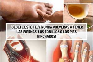 El Mejor Té para Aliviar Piernas Hinchadas: Un Diurético Natural para Tobillos y Pies