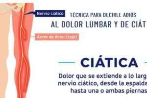 Sencilla Técnica para Decirle Adiós al Dolor Lumbar y de Ciática