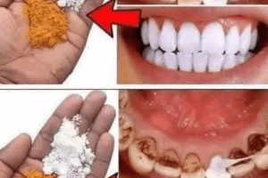 El Blanqueamiento Dental Natural que los Dentistas No Te Cuentan: Resultados en Solo 2 Minutos