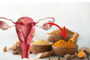 Remedios Naturales para Quistes, Fibromas y Miomas