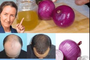 El Poder del Aceite de Cebolla para un Cabello Más Fuerte y Saludable