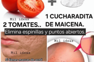 Mascarilla Casera de Tomate y Maicena: Solución Natural para Espinillas y Puntos Negros